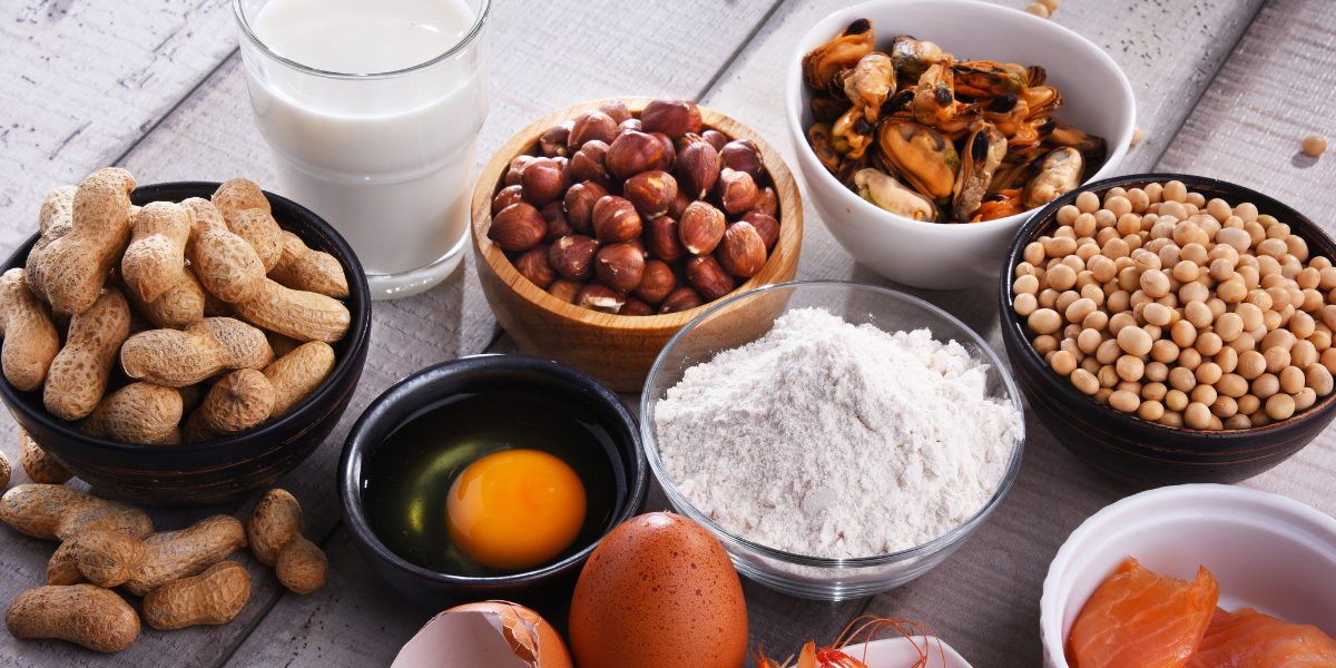 Common foods that people may have sensitivities to like, dairy, nuts, eggs and wheat.